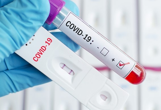 777 са новите случаи на коронавирус у нас за последното